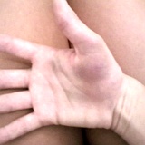 2009-Broken-Right-Hand-04-(9)